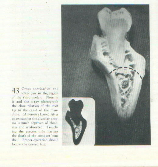 Fischer,
          Fig. 43, p. 87